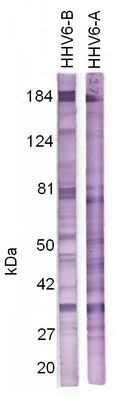 Antigen is Virusys # H6V281 and H6V282 HHV-6 Density Gradient Purified Virus at 10 ug/cm. Antibody was used 1:400. 