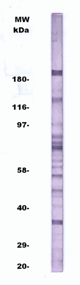 Antigen is Virusys # H7V286 HHV-7 Infected Cell Extract at 10 ug/cm. Antibody was used 1:250.